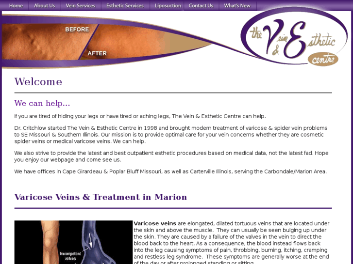 www.marion-varicose-veins.com