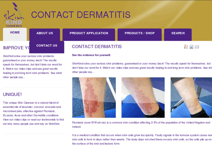 www.contact--dermatitis.com