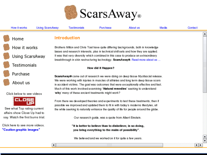 www.scarsaway.com