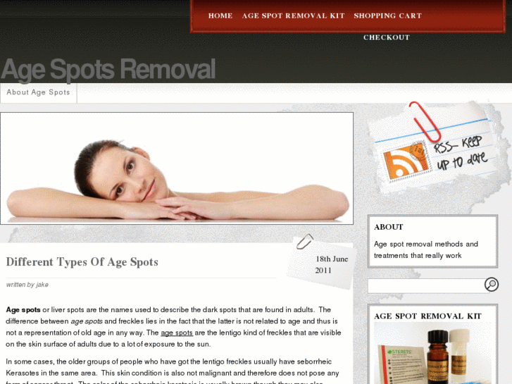 www.age-spots-removal.com