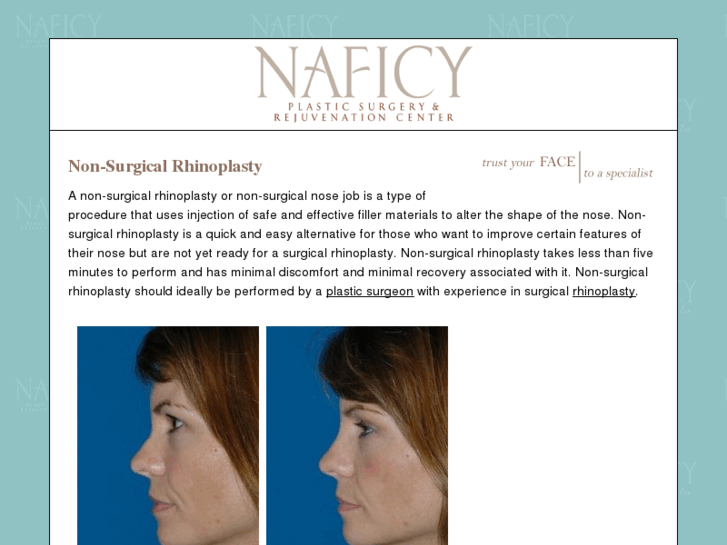 www.easyrhinoplasty.com