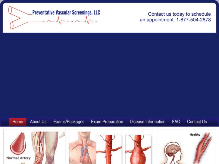 www.preventativevascular.com