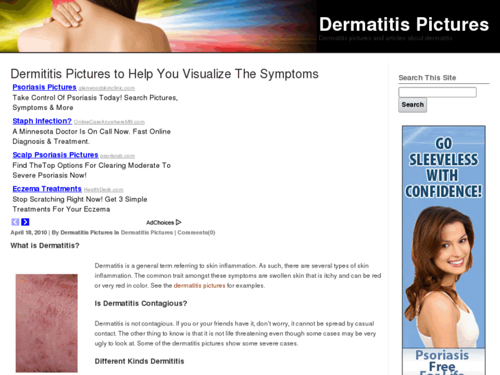 www.dermatitispictures.org