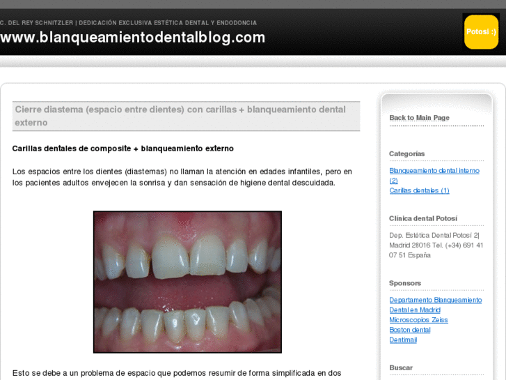 www.blanqueamientodentalblog.com