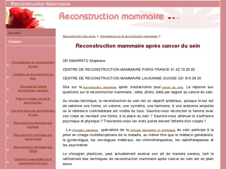 www.reconstruction-mammaire.fr