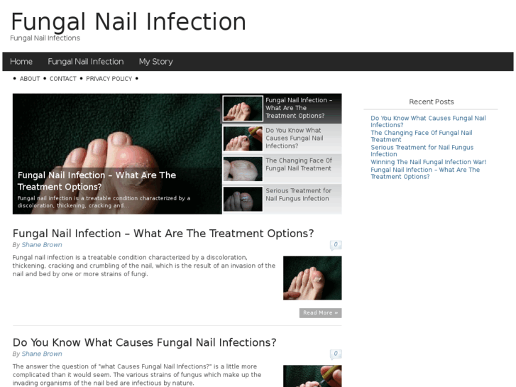 www.fungalnailinfection101.com