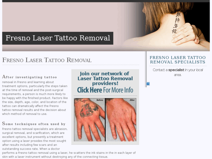 www.fresnolasertattooremoval.com