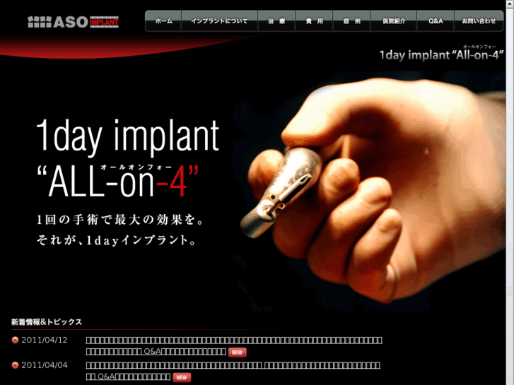 www.1day-implant.com