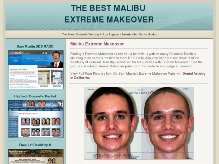 www.extreme-makeovers-malibu-california.com