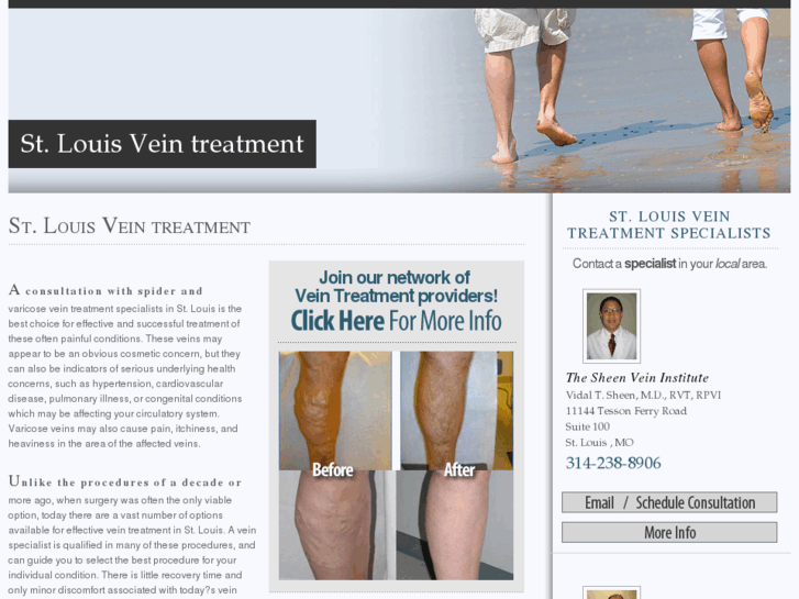 www.stlouisvaricoseveintreatment.com