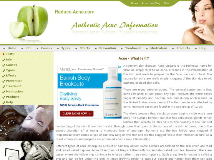 www.reduce-acne.com