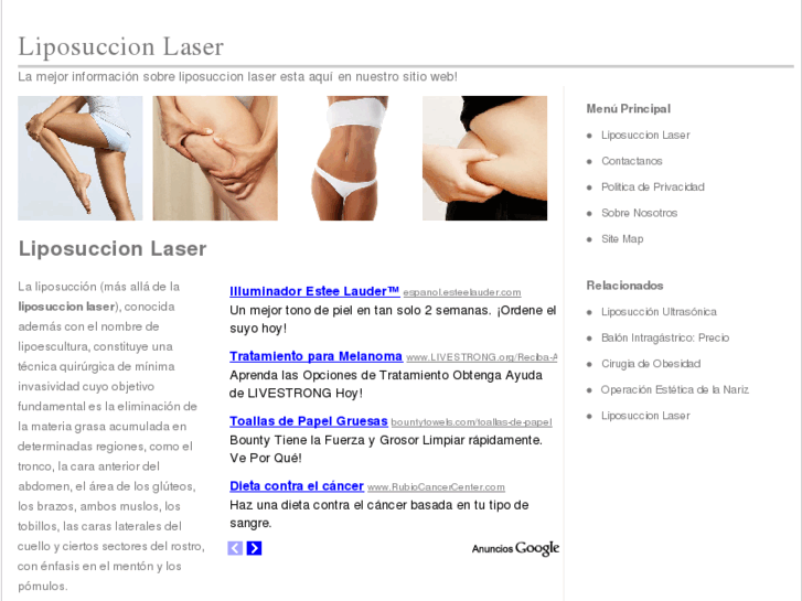 www.liposuccionlaser.org