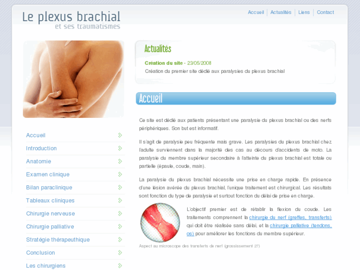 www.plexus-brachial.com