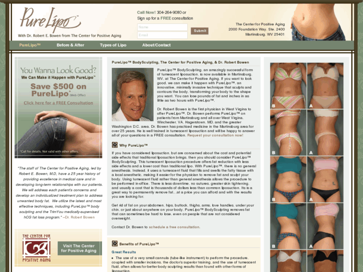 www.liposuctionwv.com