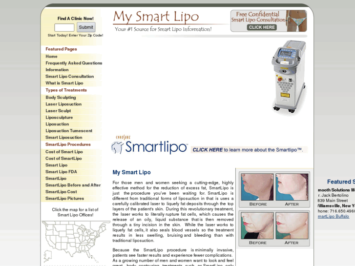 www.mysmartlipo.com