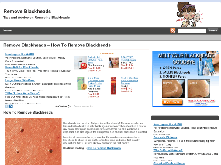 www.remove-blackheads.com