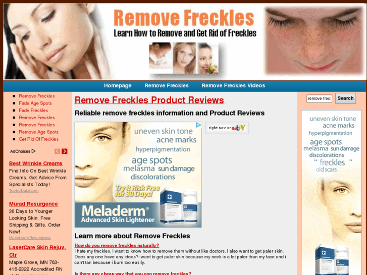 www.removefreckles.net