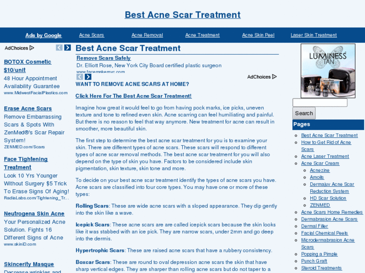 www.bestacnescartreatment.info