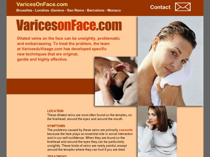 www.varicesonface.com