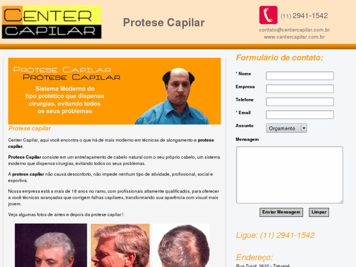 www.protesecapilar.net