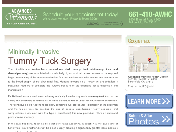 www.bakersfieldtummytuck.com