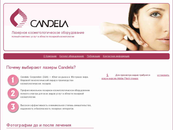 www.candelalaser.ru