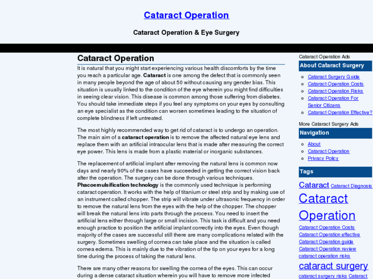 www.cataract-operation.net