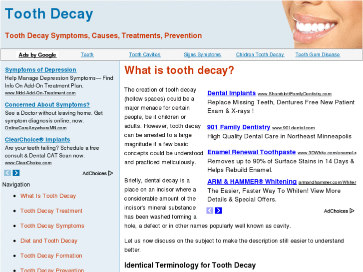 www.toothdecaycauses.com