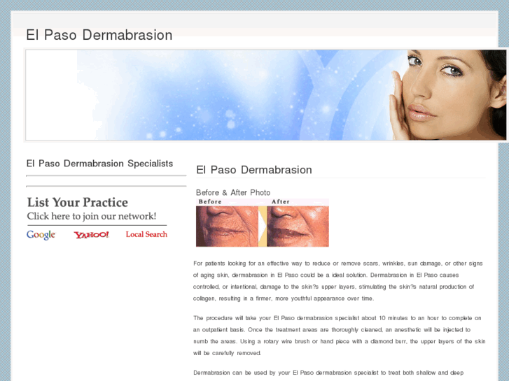 www.elpasodermabrasion.com