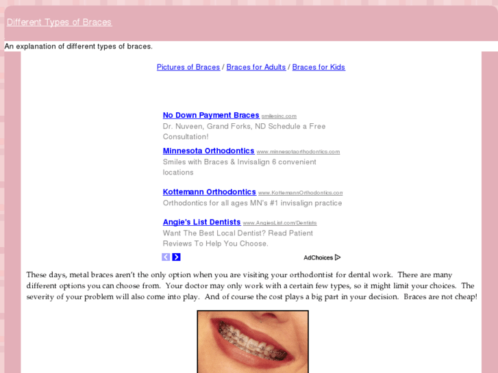 www.differenttypesofbraces.com