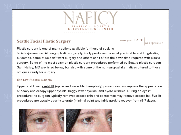 www.seattlefacialplasticsurgery.com