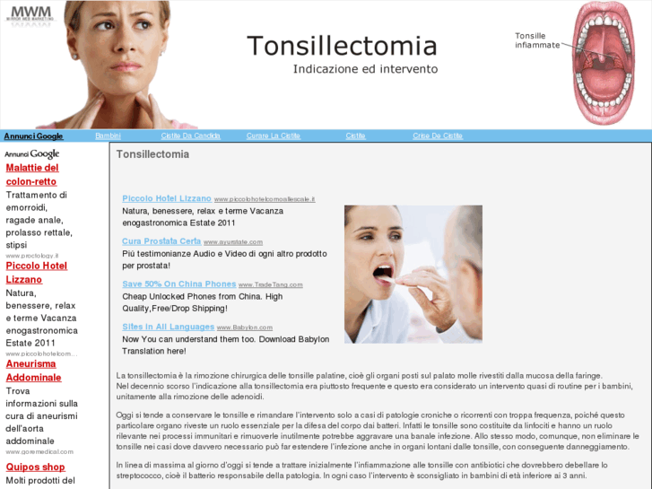 www.tonsillectomia.net