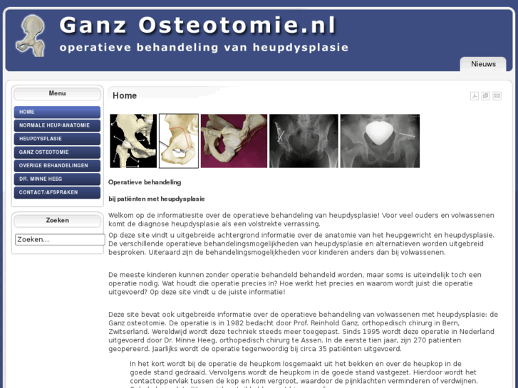 www.ganzosteotomie.nl