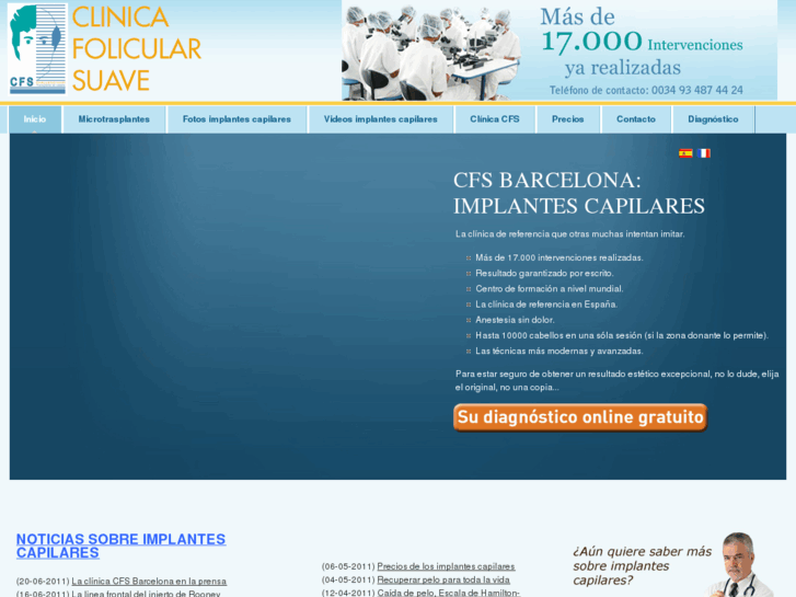 www.implantes-capilares.es