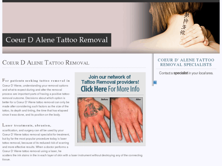 www.coeurdalenetattooremoval.com