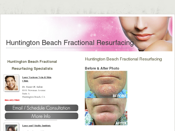 www.huntingtonbeachfractionalresurfacing.com