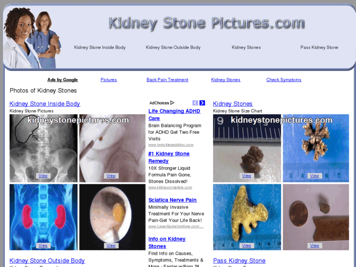 www.kidneystonepictures.com