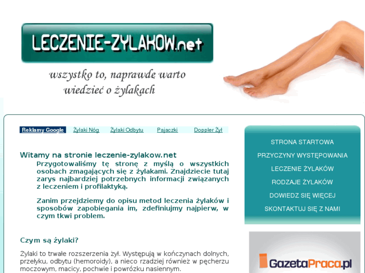 www.leczenie-zylakow.net