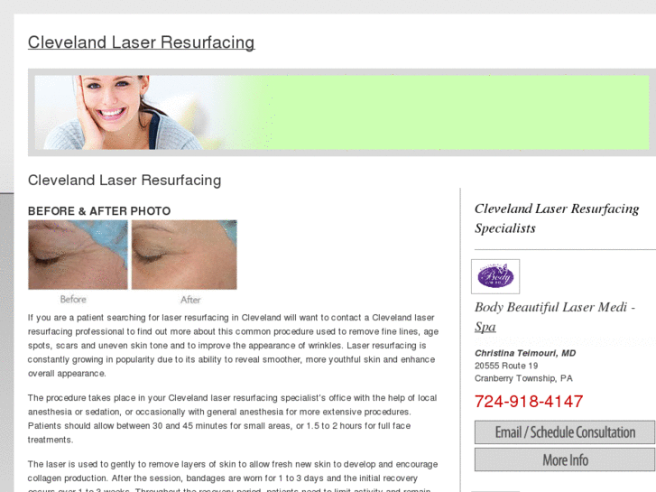 www.clevelandlaserresurfacing.com