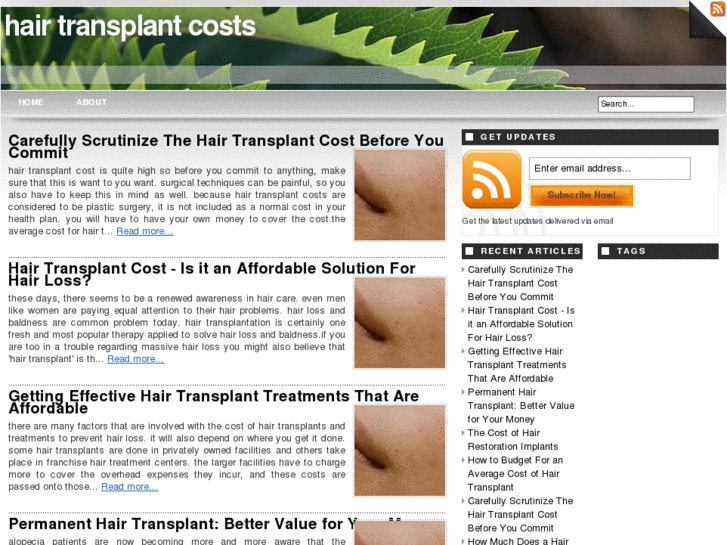 www.hairtransplantcosts.info