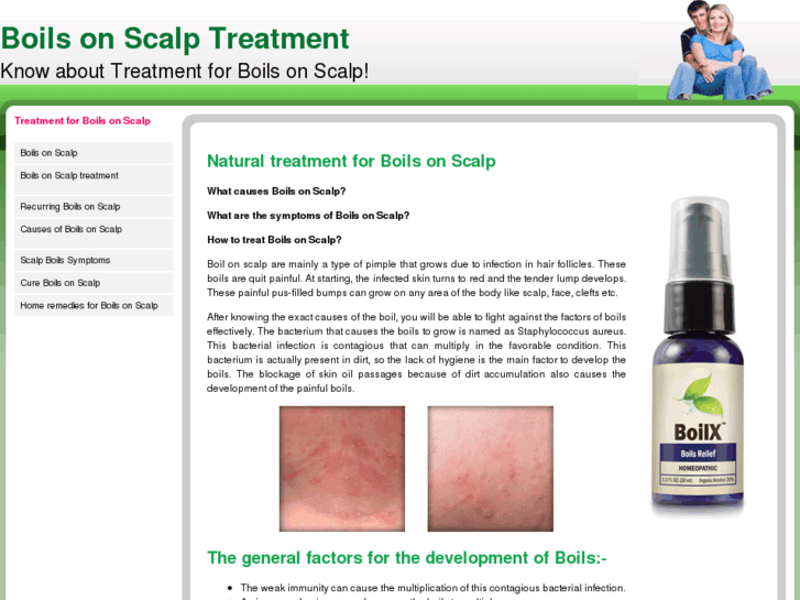 www.boilsonscalp.com