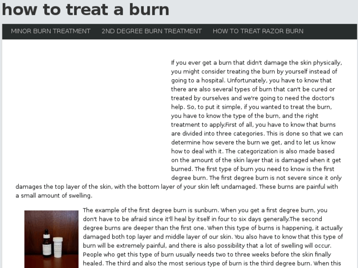 www.howtotreataburn.net