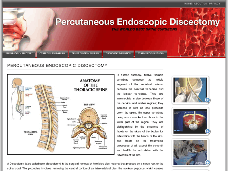 www.percutaneousendoscopicdiscectomy.info