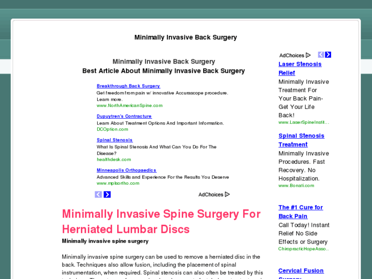 www.minimallyinvasivebacksurgery.net