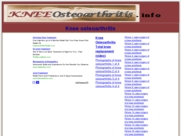 www.kneeosteoarthritis.info