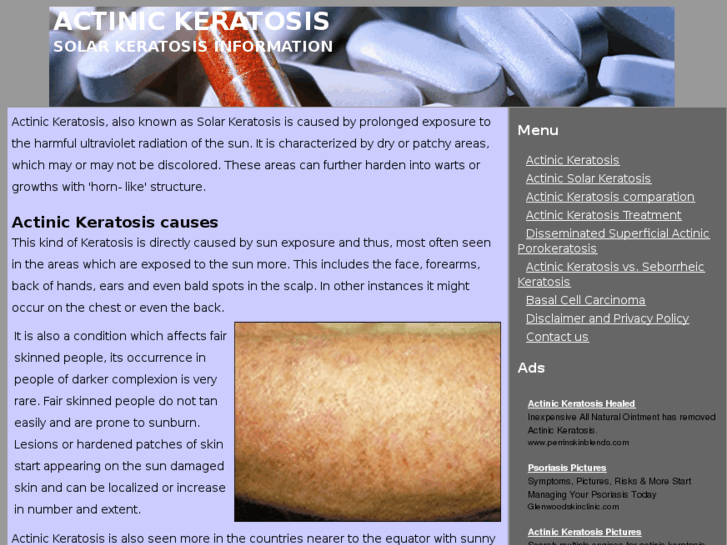 www.actinic-keratosis.info