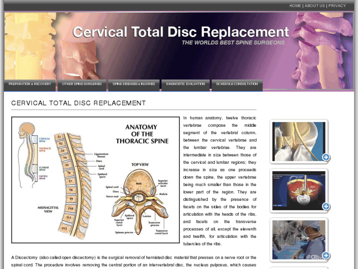 www.cervicaltotaldiscreplacement.info