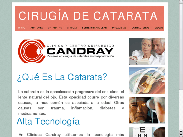 www.visionsincataratas.com