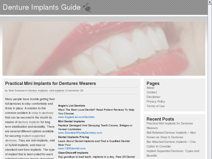 www.dentureimplantsguide.com