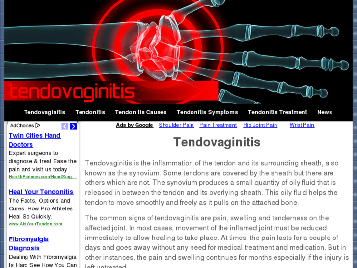 www.tendovaginitis.com